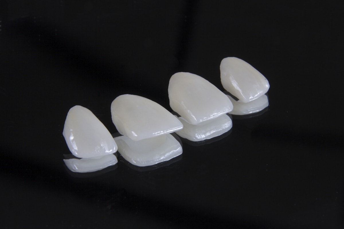 Lumineers no-prep veneers